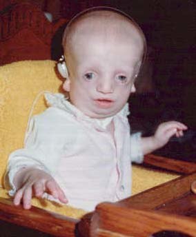 Amie at 5 months old